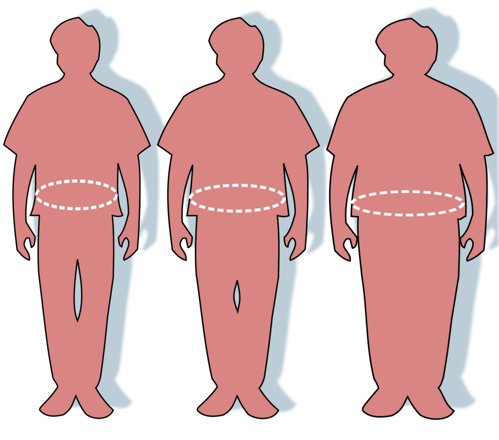 2000px Obesity waist circumference.svg